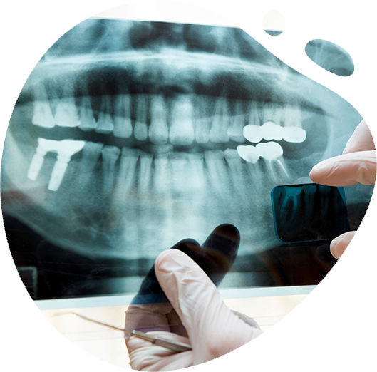 https://studiocaldera.com/wp-content/uploads/2024/02/radiologia.png